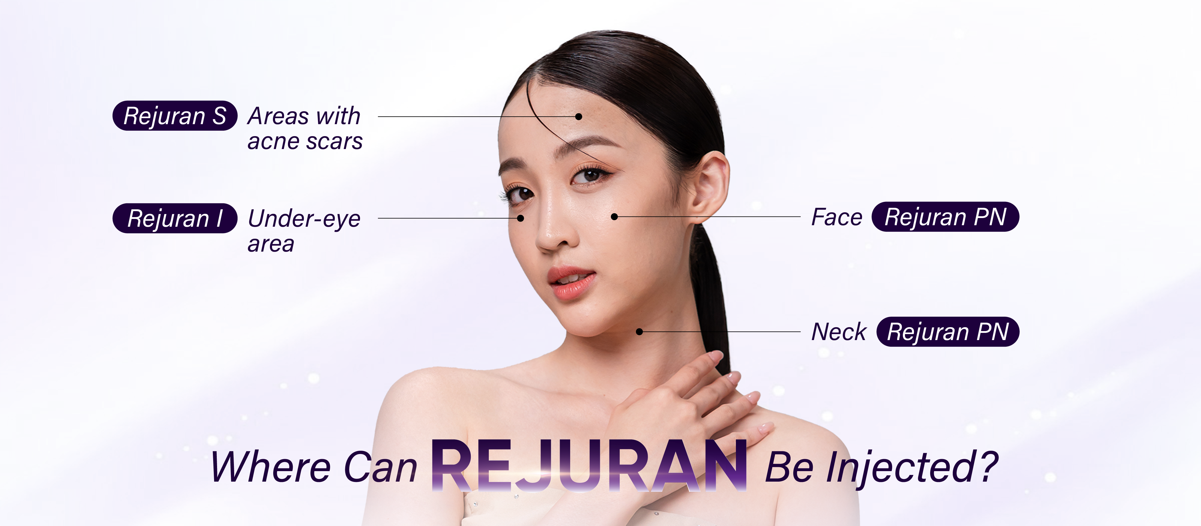 Rejuran treatment areas